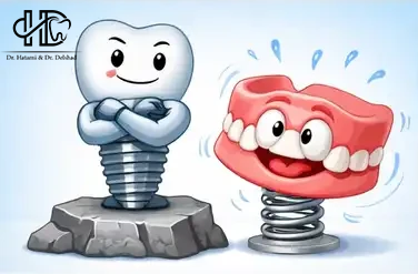 denture vs implant