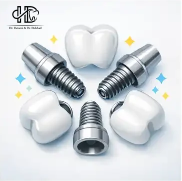 whats implant