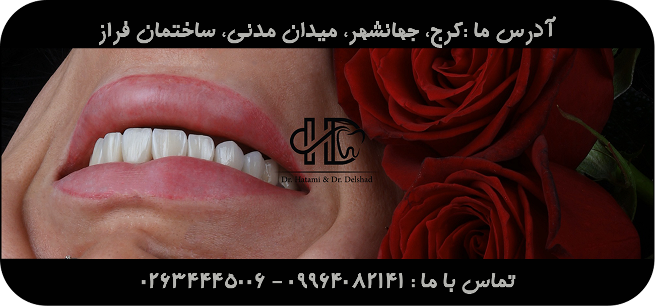 slide-image-undefined