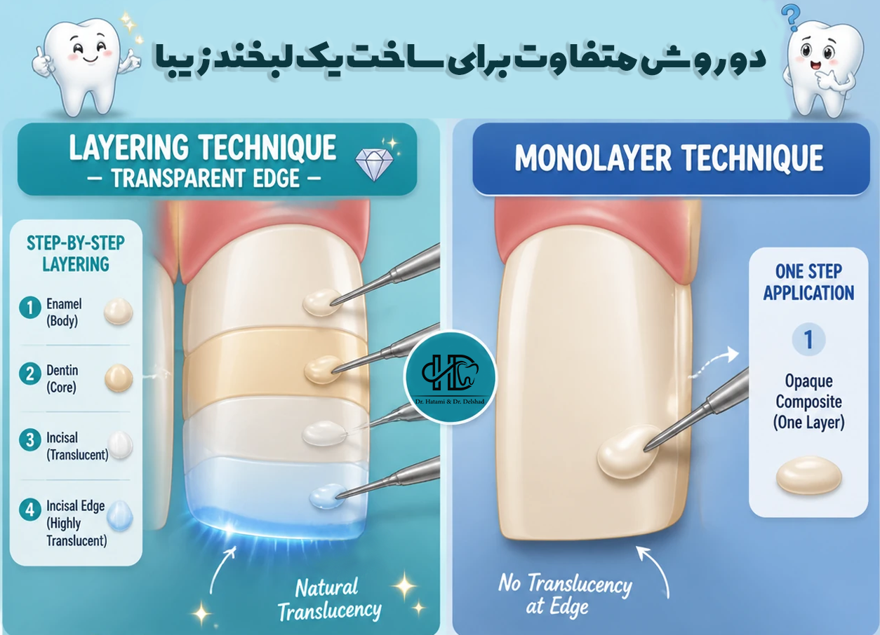 عکس تفاوت مونو و لیر